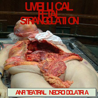 Umbilical Fetal Strangulation