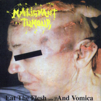 Malignant Tumour
