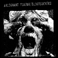 Malignant Tumour